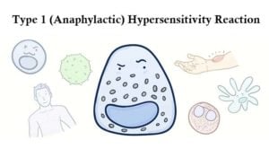 Type 1 (Anaphylactic) Hypersensitivity Reaction