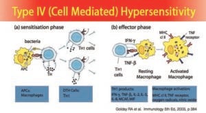 Type IV (Cell Mediated) Hypersensitivity- Mechanism and Examples