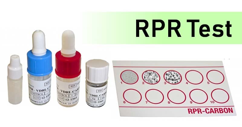 Rapid Plasma Reagin (RPR) Test