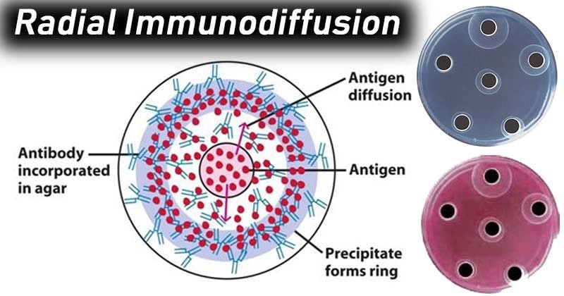 Radial Immunodiffusion- Objectives, Principle, Procedure ...