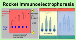 Result Interpretation of Rocket Immunoelectrophoresis