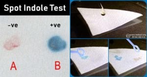 Result Interpretation of Spot Indole Test