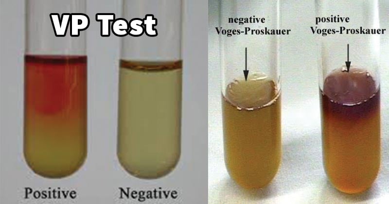 Result Interpretation of VP Test