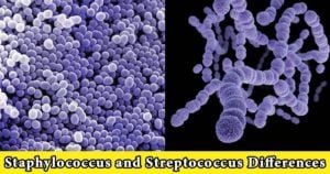 Staphylococcus and Streptococcus Differences