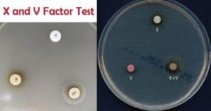 X and V Factor Test for Haemophilus