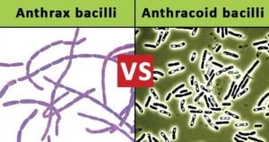 Differences between Anthrax bacilli and Anthracoid bacilli