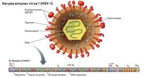 Herpes simplex virus 1 (HSV-1)