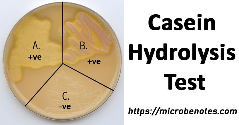 Casein Hydrolysis Test Biochemical Test Microbe Notes