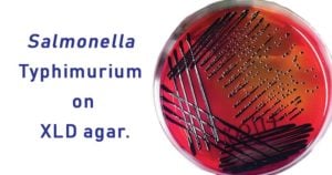 Salmonella Typhimurium on XLD agar.