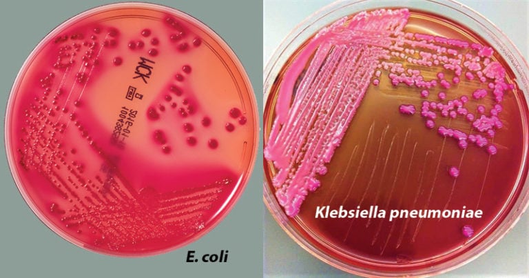 MacConkey Agar- Composition, Principle, Preparation, Results, Uses