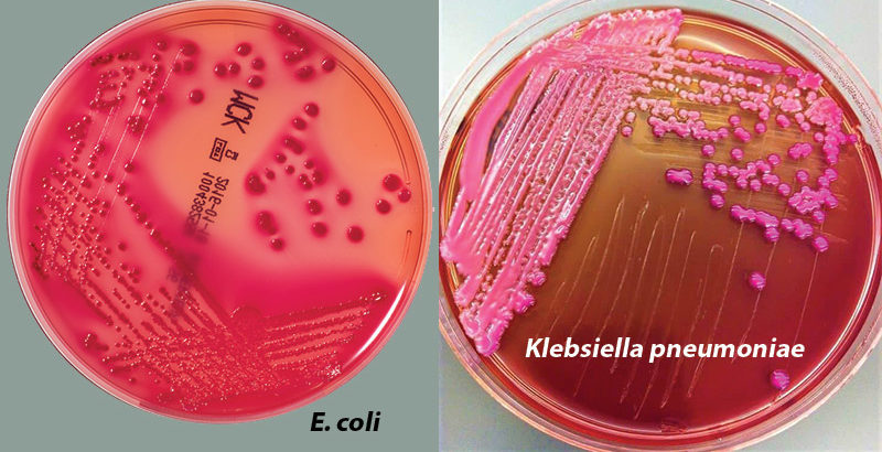 Result Interpretation on MacConkey Agar