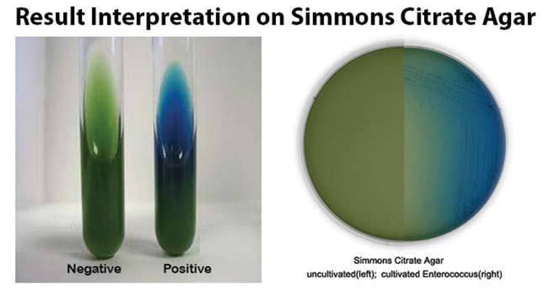 Result Interpretation on Simmons Citrate Agar