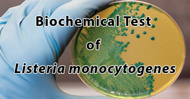 Biochemical Test of Listeria monocytogenes