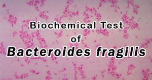 Biochemical Test of Bacteroides fragilis