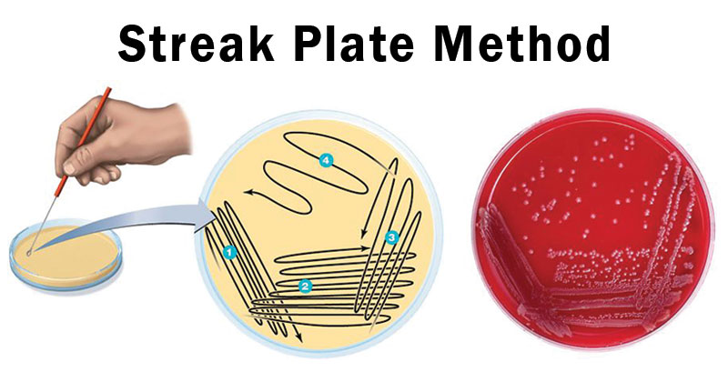 advantages and disadvantages of the serial dilution agar plate technique