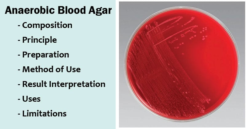 anaerobic-blood-agar-composition-principle-preparation-results-uses