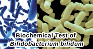 Biochemical Test of Bifidobacterium bifidum