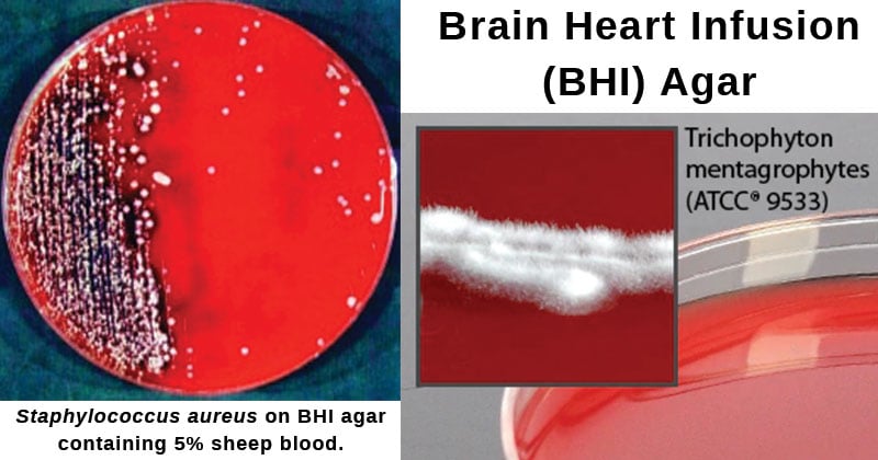 Brain Heart Infusion (BHI) Agar
