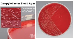 Campylobacter Blood Agar (CVA)