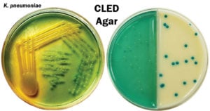 Cystine Lactose Electrolyte Deficient (CLED) Agar