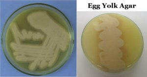 Egg Yolk Agar