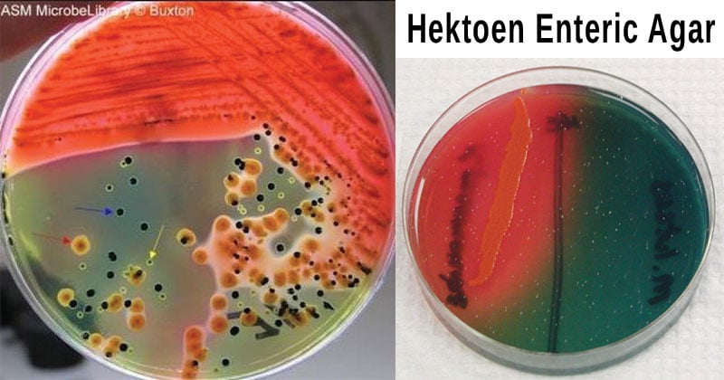 xld agar results