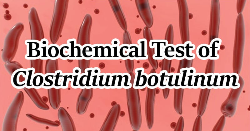 Biochemical Test of Clostridium botulinum