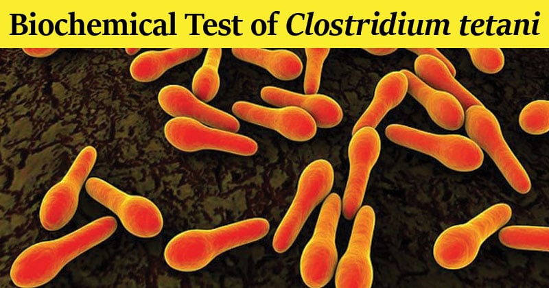 Biochemical Test of Clostridium tetani