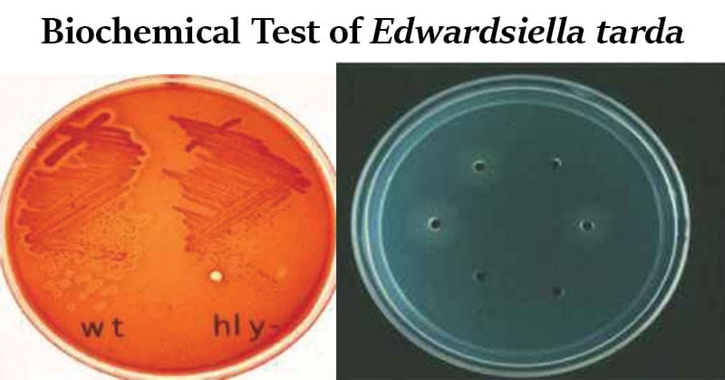 Biochemical Test of Edwardsiella tarda