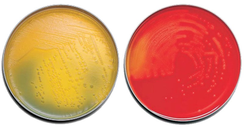 Globo Cancelar Frotar Tryptic Soy Agar- Composition, Principle, Preparation, Results, Uses