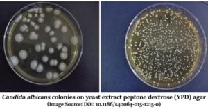 Yeast Extract Peptone Dextrose (YPD or YEPD) Agar