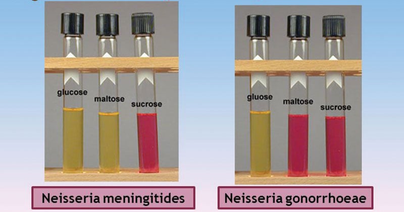 Cystine Tryptic Agar