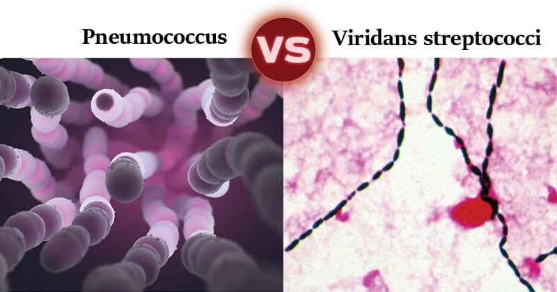 Pneumococcus vs Viridans streptococci- 12 Major Differences