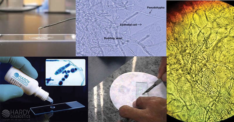 koh-test-potassium-hydroxide-test-principle-procedure-results-uses-my