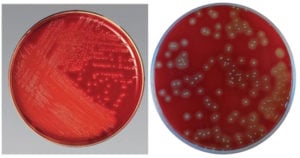 Streptococcus Selective Agar