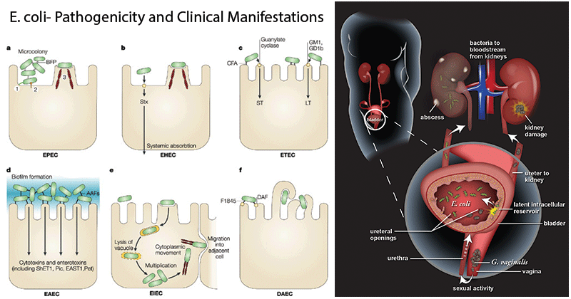 E. coli- Pathogenicity and Clinical Manifestations