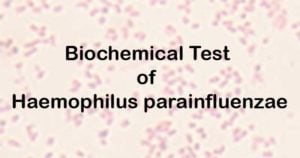 Biochemical Test of Haemophilus parainfluenzae