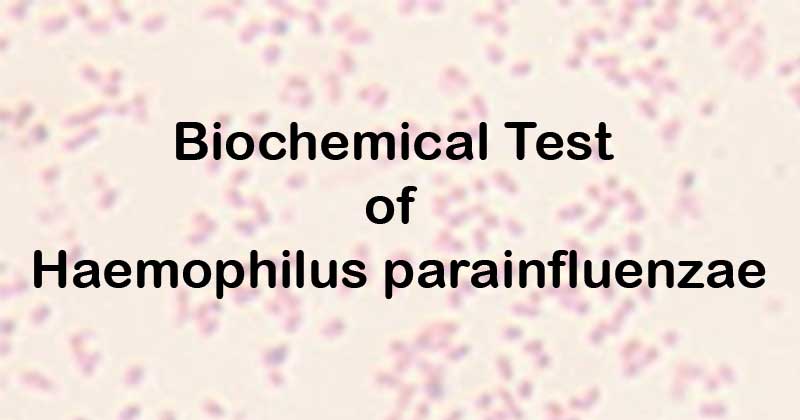 Biochemical Test of Haemophilus parainfluenzae