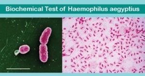 Biochemical Test of Haemophilus aegyptius