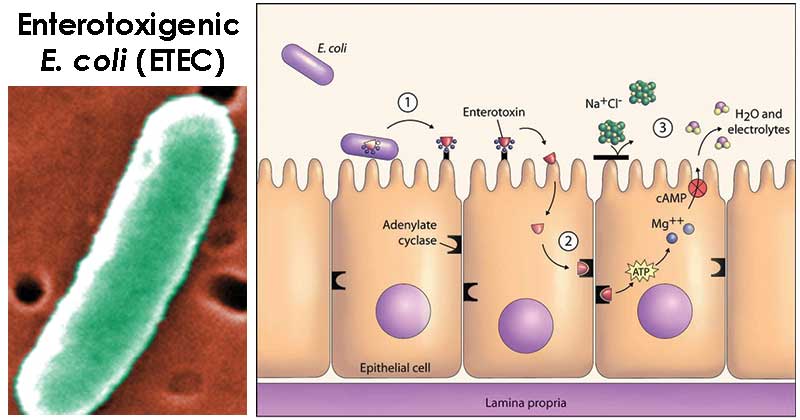 Enterotoxigenic E. coli (ETEC)