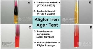 Kligler Iron Agar Test