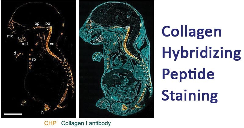 Collagen Hybridizing Peptide Staining