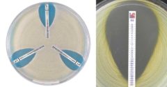 Epsilometer Test (E-test): Principle, Procedure, Results, Uses