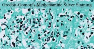 Grocott-Gomori's Methenamine Silver Staining