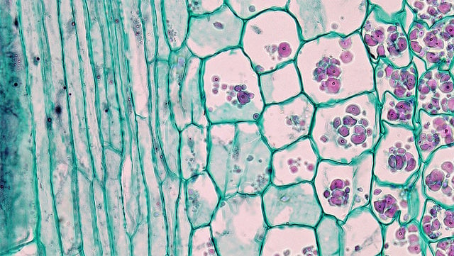 Parenchyma cells diagram