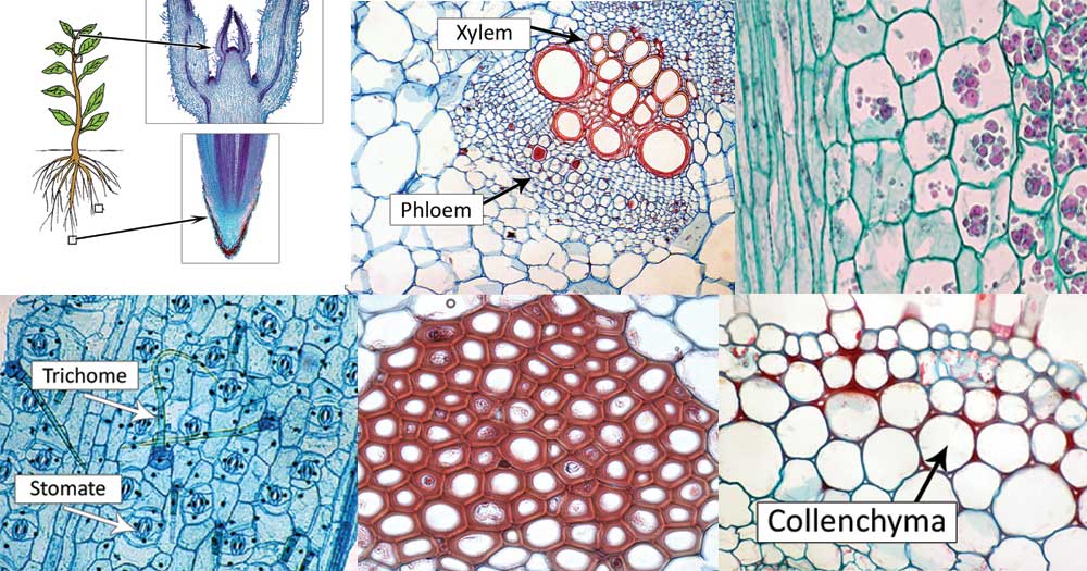 plant cells under a microscope labeled