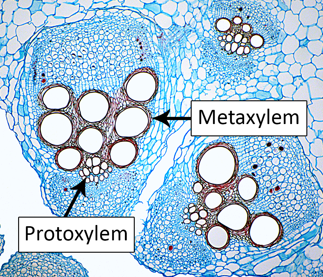 protoxylem and metaxylem