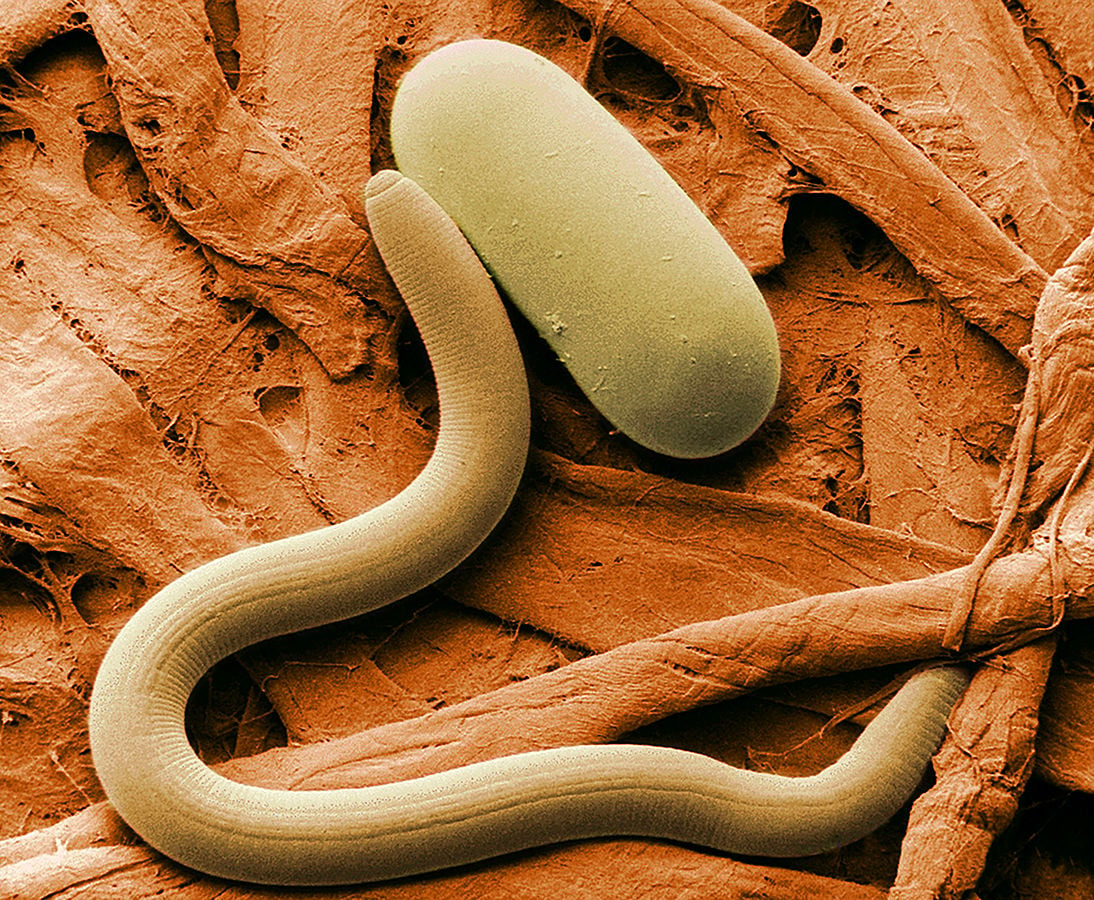 Low-temperature scanning electron micrograph of soybean cyst nematode and its egg. Magnified 1,000 times.