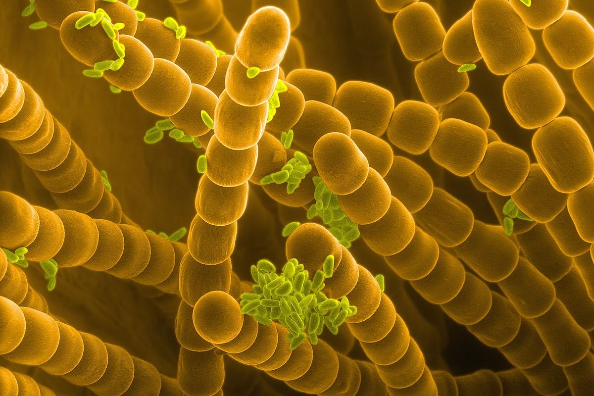SEM image of Tradescantia pollen and stamens.