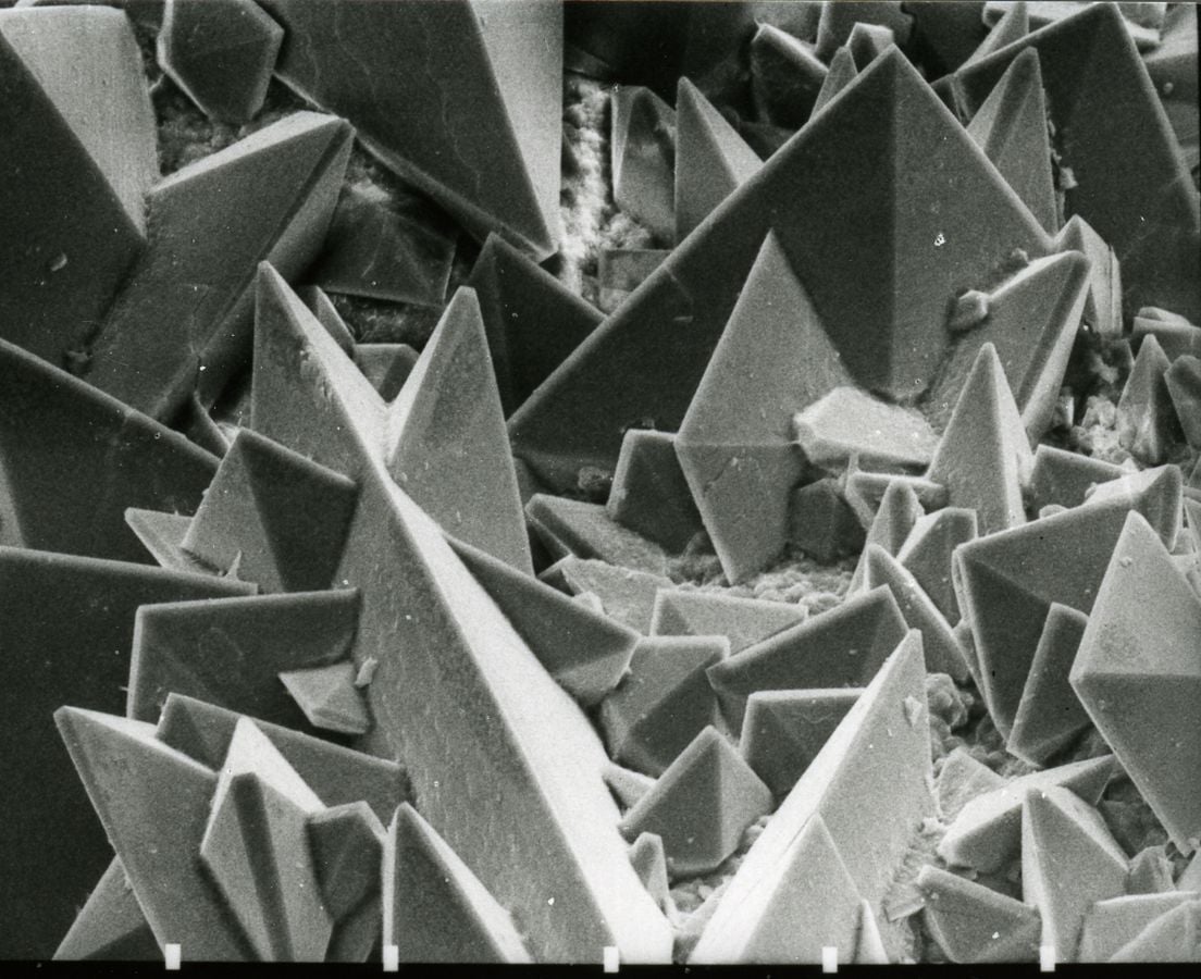 Scanning Electron Micrograph of the surface of a kidney stone showing tetragonal crystals of Weddellite (calcium oxalate dihydrate) emerging from the amorphous central part of the stone
